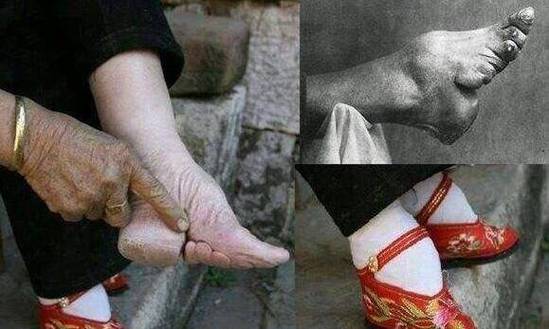 三寸金莲起源于何时(三寸金莲始于什么朝代)-第8张图片-文史 三寸金莲起源于何时(三寸金莲始于什么朝代)-第8张图片-文史